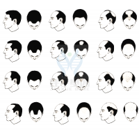 【Ebpay基因检测】过早<font color='red'>脱发</font>、掉发太多怎么办？你的方法可能是错的！